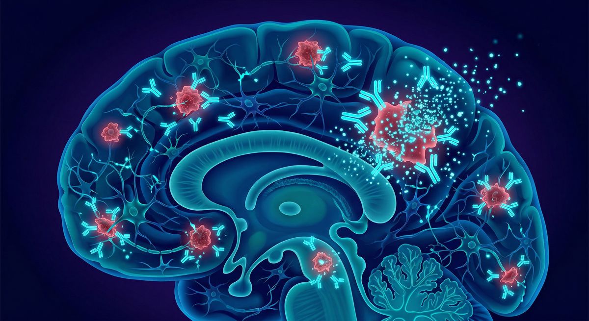 Lecanemab e Donanemab: Os Primeiros Medicamentos que Freiam o Alzheimer